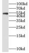 Myocyte Enhancer Factor 2C antibody, FNab05102, FineTest, Western Blot image 