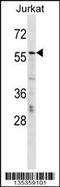 Protein CBFA2T2 antibody, TA324594, Origene, Western Blot image 