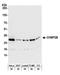 Charged Multivesicular Body Protein 2B antibody, A304-501A, Bethyl Labs, Western Blot image 