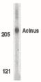 Apoptotic Chromatin Condensation Inducer 1 antibody, PA5-19940, Invitrogen Antibodies, Western Blot image 