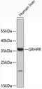 Glyoxylate And Hydroxypyruvate Reductase antibody, 19-334, ProSci, Western Blot image 