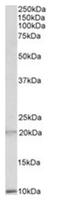 Defensin Alpha 1B antibody, AP23709PU-N, Origene, Western Blot image 