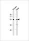 Protein TFG antibody, 59-694, ProSci, Western Blot image 