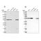 Peptidase, Mitochondrial Processing Alpha Subunit antibody, NBP2-57169, Novus Biologicals, Western Blot image 