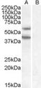 Diacylglycerol O-Acyltransferase 2 antibody, STJ71113, St John