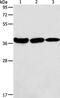 N(4)-(beta-N-acetylglucosaminyl)-L-asparaginase antibody, PA5-50309, Invitrogen Antibodies, Western Blot image 