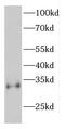 Espin antibody, FNab02865, FineTest, Western Blot image 