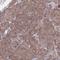 B Cell Receptor Associated Protein 29 antibody, HPA049694, Atlas Antibodies, Immunohistochemistry frozen image 
