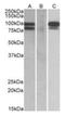 Proprotein Convertase Subtilisin/Kexin Type 9 antibody, orb125010, Biorbyt, Western Blot image 