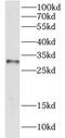 3,2-trans-enoyl-CoA isomerase, mitochondrial antibody, FNab02264, FineTest, Western Blot image 