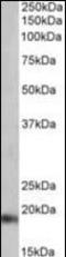 Natriuretic Peptide A antibody, orb178861, Biorbyt, Western Blot image 