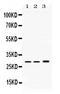 Proteasome Subunit Alpha 1 antibody, PB10087, Boster Biological Technology, Western Blot image 