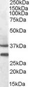 Nuclear receptor subfamily 1 group I member 2 antibody, 46-930, ProSci, Western Blot image 