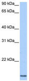 Cyclin L2 antibody, TA339761, Origene, Western Blot image 