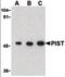 Golgi-associated PDZ and coiled-coil motif-containing protein antibody, orb87313, Biorbyt, Western Blot image 