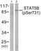 Signal Transducer And Activator Of Transcription 5B antibody, PA5-38093, Invitrogen Antibodies, Western Blot image 