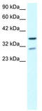 Zinc Finger Protein 385A antibody, TA330594, Origene, Western Blot image 