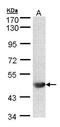 Chitobiosyldiphosphodolichol beta-mannosyltransferase antibody, GTX103537, GeneTex, Western Blot image 