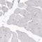 Cbl Proto-Oncogene antibody, HPA027956, Atlas Antibodies, Immunohistochemistry paraffin image 