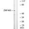 Zinc Finger Protein 460 antibody, A14143, Boster Biological Technology, Western Blot image 