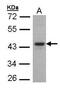 Forkhead box protein E1 antibody, GTX100275, GeneTex, Western Blot image 