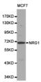 Sphingosine-1-Phosphate Receptor 5 antibody, TA326848, Origene, Western Blot image 