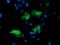 Low Density Lipoprotein Receptor Adaptor Protein 1 antibody, MA5-25757, Invitrogen Antibodies, Immunocytochemistry image 