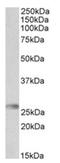 HLA class II histocompatibility antigen, DQ alpha 2 chain antibody, AP31719PU-N, Origene, Western Blot image 