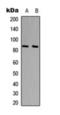 UTP14A Small Subunit Processome Component antibody, orb393185, Biorbyt, Western Blot image 