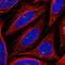 Centrosomal Protein 164 antibody, HPA061504, Atlas Antibodies, Immunofluorescence image 