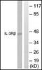 Colony Stimulating Factor 2 Receptor Beta Common Subunit antibody, orb95553, Biorbyt, Western Blot image 