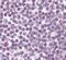 DEAD-Box Helicase 18 antibody, PA5-23463, Invitrogen Antibodies, Immunohistochemistry paraffin image 