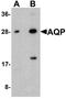 Aquaporin 2 antibody, TA326697, Origene, Western Blot image 