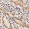 TAP Binding Protein antibody, A1968, ABclonal Technology, Immunohistochemistry paraffin image 