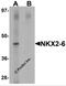 NK2 Homeobox 6 antibody, 6751, ProSci, Western Blot image 