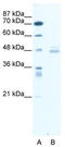 LIM Domain Binding 1 antibody, TA331480, Origene, Western Blot image 
