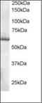 Thioredoxin Reductase 1 antibody, orb89284, Biorbyt, Western Blot image 