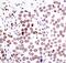PC4 And SFRS1 Interacting Protein 1 antibody, MA5-14821, Invitrogen Antibodies, Immunohistochemistry paraffin image 