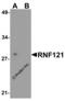 Ring Finger Protein 121 antibody, 8285, ProSci Inc, Western Blot image 