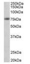 Amyloid Beta Precursor Protein antibody, orb12385, Biorbyt, Western Blot image 