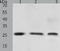 TIMP Metallopeptidase Inhibitor 4 antibody, TA321564, Origene, Western Blot image 