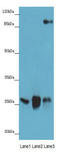 DnaJ Heat Shock Protein Family (Hsp40) Member C30 antibody, A56807-100, Epigentek, Western Blot image 