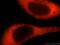 40S ribosomal protein S14 antibody, 16683-1-AP, Proteintech Group, Immunofluorescence image 