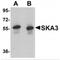 Spindle And Kinetochore Associated Complex Subunit 3 antibody, MBS151003, MyBioSource, Western Blot image 