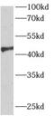 B78 antibody, FNab00485, FineTest, Western Blot image 