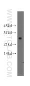 Gap Junction Protein Beta 2 antibody, 51037-2-AP, Proteintech Group, Western Blot image 