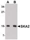 Spindle And Kinetochore Associated Complex Subunit 2 antibody, PA5-20818, Invitrogen Antibodies, Western Blot image 