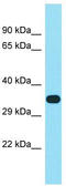 Family With Sequence Similarity 102 Member B antibody, TA336127, Origene, Western Blot image 