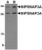 Nipsnap Homolog 3A antibody, TA306692, Origene, Western Blot image 