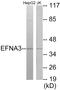 Ephrin A3 antibody, EKC1746, Boster Biological Technology, Western Blot image 